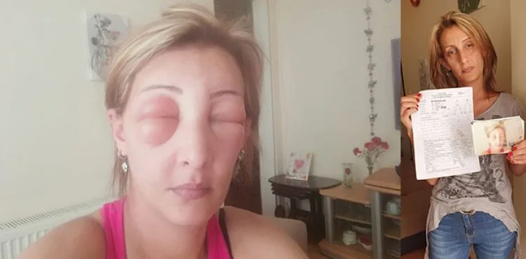 Saçlarını yaptırmak için kuaföre gitti, canından oluyordu