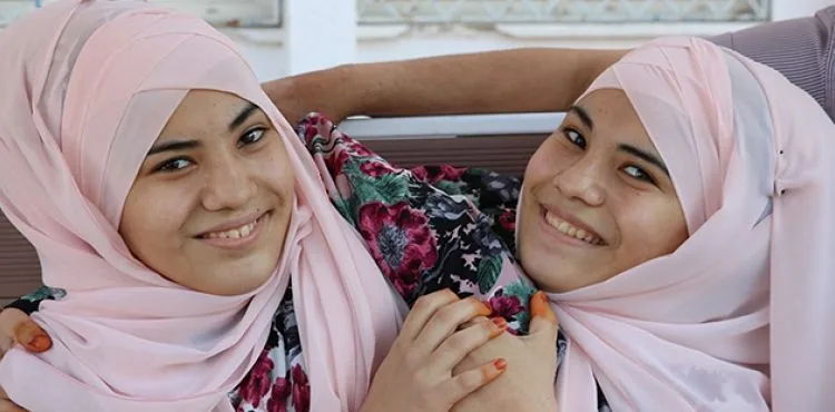 Siyam ikizlerinin üniversite hayali gerçek oluyor