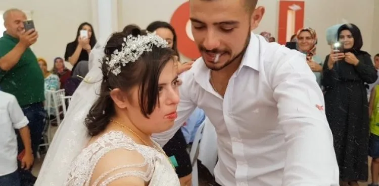 Down sendromlu Rabia'ya damatsız düğün