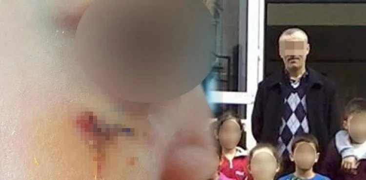 Öğrencisini kitapla yaralayan öğretmen hakkında karar!