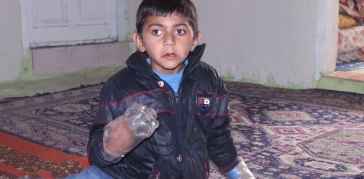 Minik Yusuf'un dramı: Sürekli ısırdığı ellerini plastik şişeye bağlıyorlar