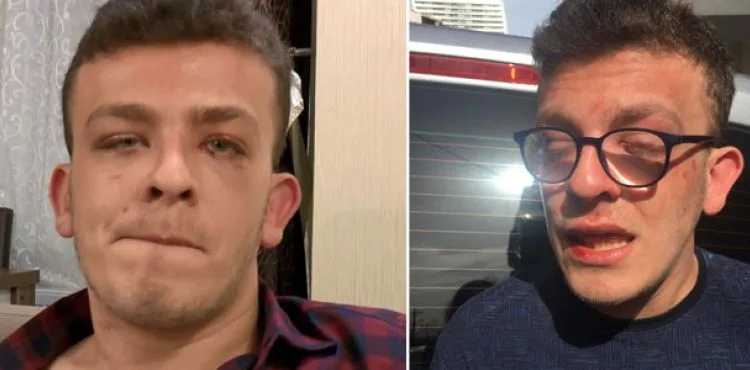 Avcılar'da bir kişi otizmli genci hastanelik etti