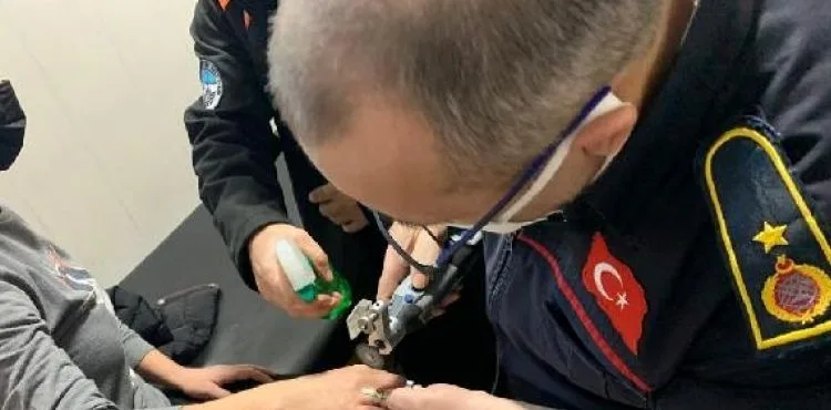 Parmağına sıkışan yüzüğü itfaiye keserek çıkardı