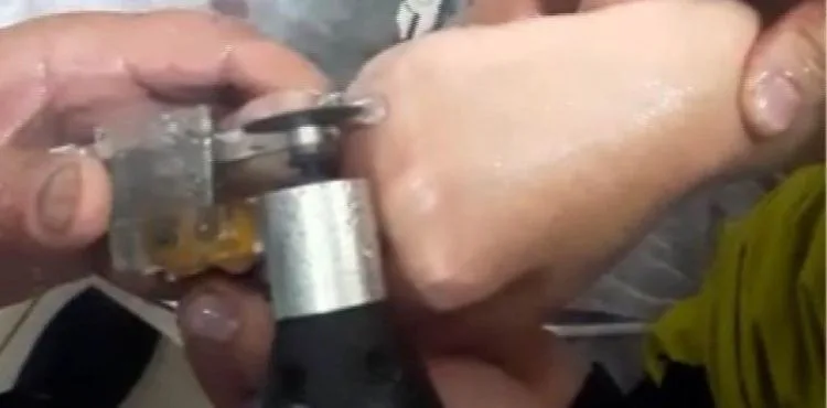 Parmağı kangren olmadan kurtardılar