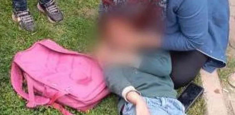 Otomobil çocuğa çarptı