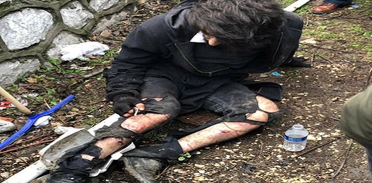 Üniversite öğrencisi köpek saldırısıyla yaralandı