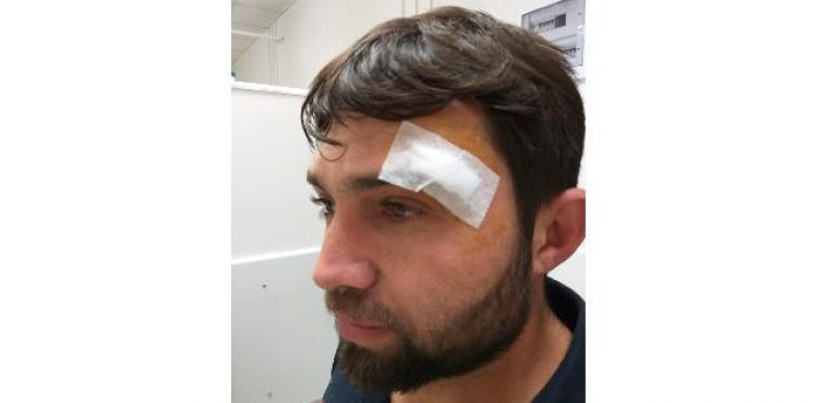 Ambulans sürücüsü darp edildi