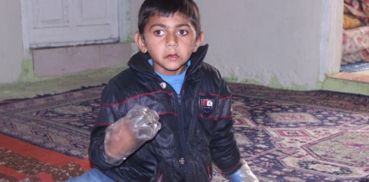 Minik Yusuf'un dramı: Sürekli ısırdığı ellerini plastik şişeye bağlıyorlar