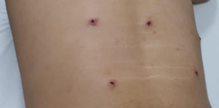 Kaybolan koyununu aramaya çıkan genç avcıların hedefi oldu