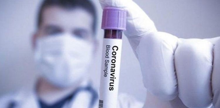ABD’de koronavirüsten ölenlerin sayısı 3 bini geçti