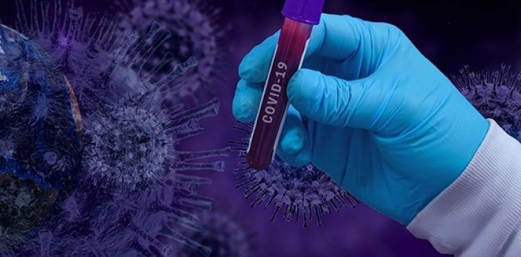 Dünya genelinde koronavirüs bilançosu: Can kaybı 316 bin 732’ye yükseldi