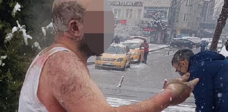 Ailesiyle tartışan kepçe operatörü, kendini yaktı