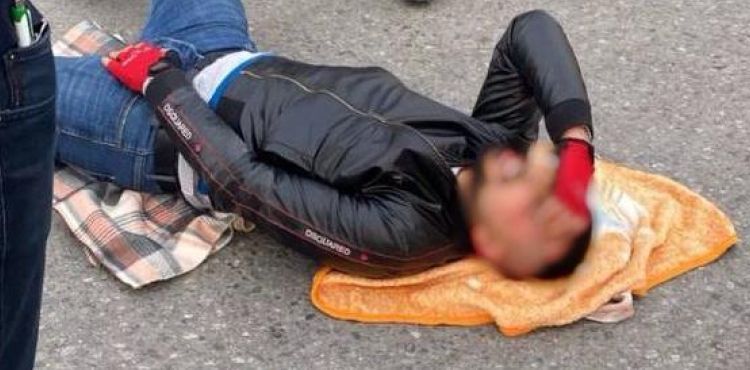 Otomobil Motosiklete Çarptı: 1 Kişi Yaralandı