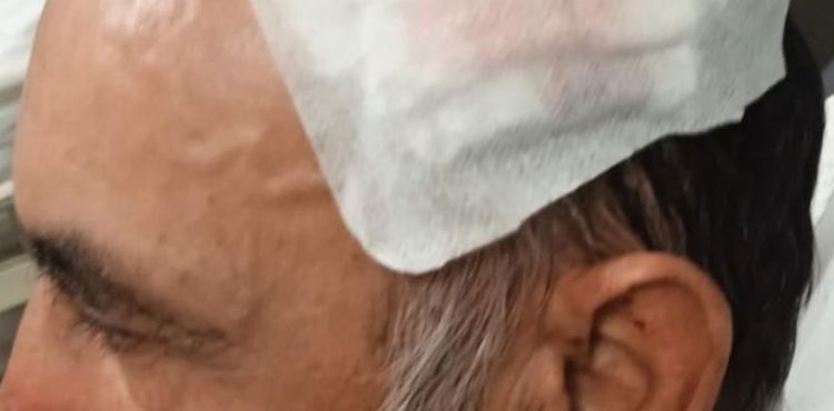 Sarıoğlan’da şok iddia: “Belediye Başkanı ve Kadın Kollarını nasıl eleştirirsin ? diye taşla saldırı