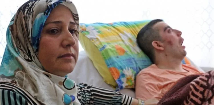 5 yıldır gözlerini kırpamıyor, adeta kan ağlıyor