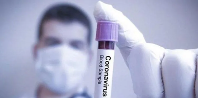 Çorum Valiliği: 497 koronavirüs testinin 29'u pozitif, 1 can kaybı var