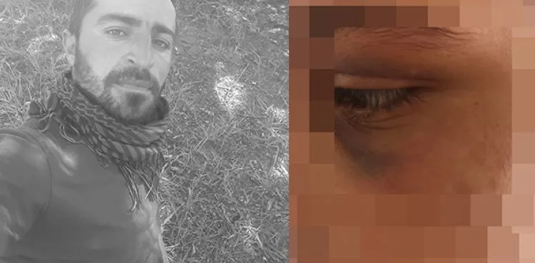Dini nikahlı eşini 6 ay boyunca zincire bağlayıp, işkence yaptı; tutuklandı